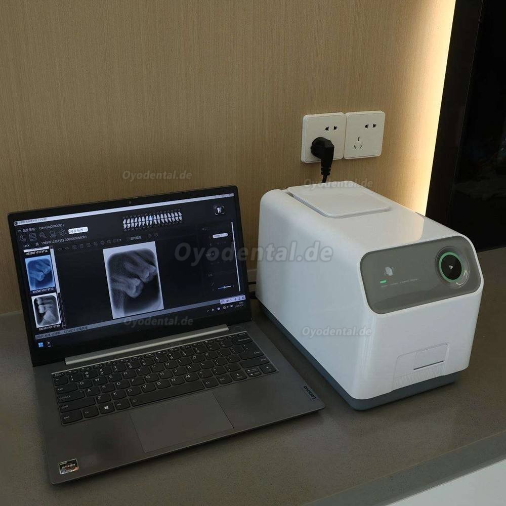 Handy IPS3 dentaler digitaler PSP-R&ouml;ntgenscanner f&uuml;r Speicherfolien